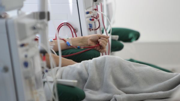 Пациент проходит медицинскую процедуру в диализном центре, фото из архива - Sputnik Азербайджан
