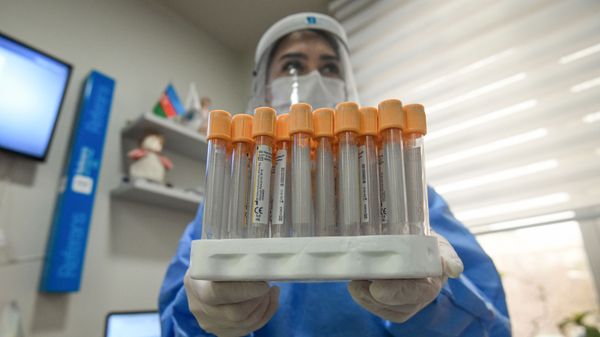Bakıda klinikaların birində koronavirus testi - Sputnik Азербайджан