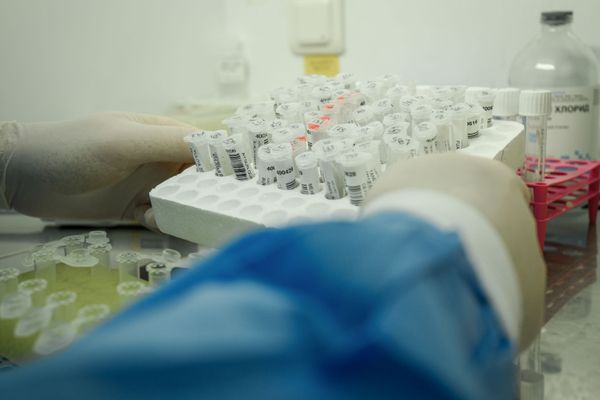Bakıda klinikaların birində koronavirus testi - Sputnik Азербайджан