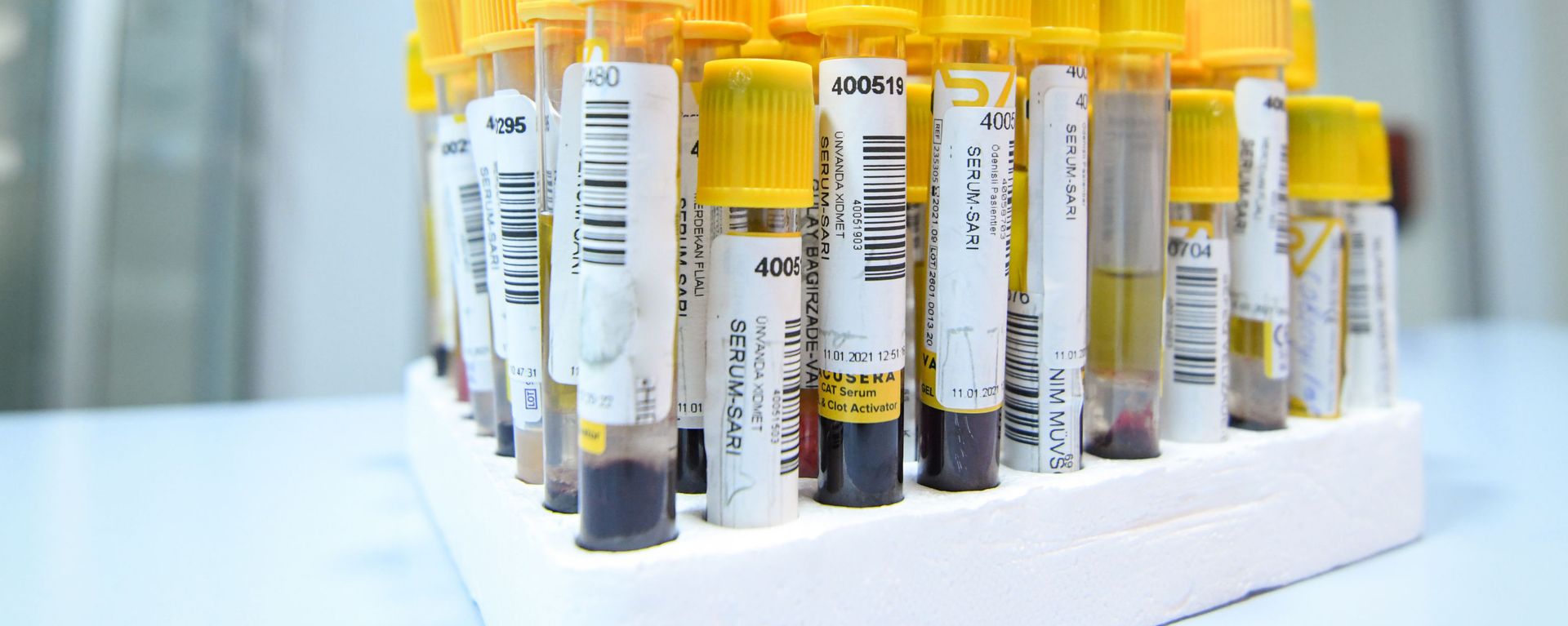 Bakıda klinikaların birində koronavirus testi - Sputnik Азербайджан, 1920, 02.04.2021