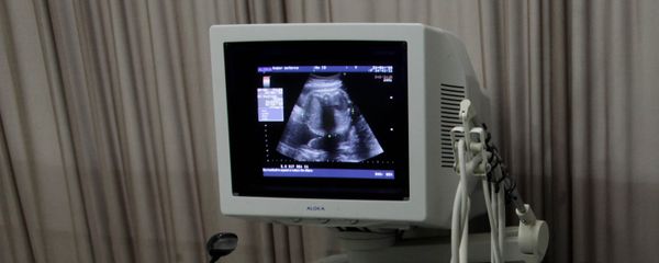 Изображение на экране монитора аппарата УЗИ во время обследования беременной женщины, фото из архива - Sputnik Азербайджан