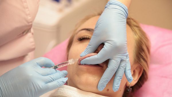 Инъекция ботокса, фото из архива - Sputnik Азербайджан