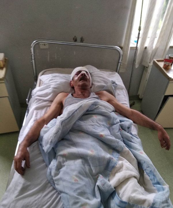 Получивший удары молотком по голове Рамиз Алиев в отделении травматологии Бардинской центральной районной больницы - Sputnik Азербайджан