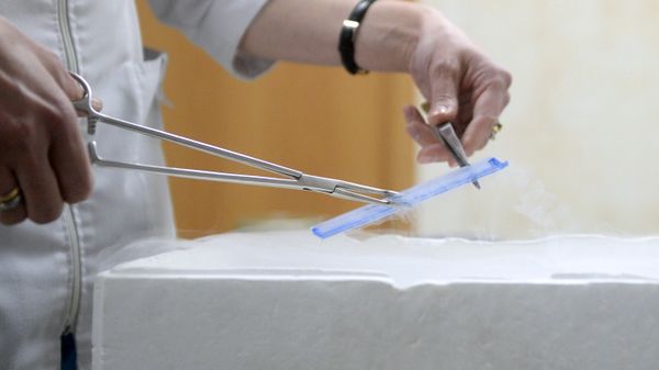 Tibbi təcrübə, arxiv şəkli - Sputnik Азербайджан
