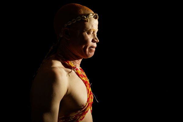 Первый  в мире конкурс красоты для альбиносов Mr. & Miss Albinism East Africa в Кении - Sputnik Азербайджан