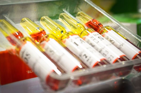 Азербайджанская международная выставка медицинских инноваций и индустрии красоты - Sputnik Азербайджан