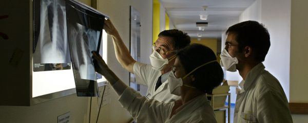 Рентген легких, фото из архива Рентген легких, фото из архива - Sputnik Азербайджан