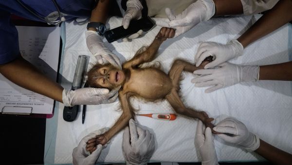 Снимок Saving Orangutans фотографа Alain Schroeder, ставший финалистом конкурса 162nd International Photography Exhibition - Sputnik Азербайджан