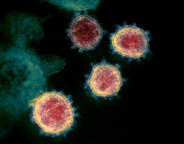 This undated transmission electron microscope image shows SARS-CoV-2, also known as novel coronavirus, the virus that causes COVID-19, isolated from a patient in the U.S. Virus particles are shown emerging from the surface of cells cultured in the lab. The spikes on the outer edge of the virus particles give coronaviruses their name, crown-like - Sputnik Азербайджан