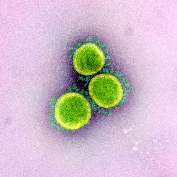 An undated transmission electron micrograph of SARS-CoV-2 virus particles, also known as novel coronavirus, the virus that causes COVID-19, isolated from a patient - Sputnik Азербайджан