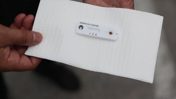 Koronavirus testi, arxiv şəkli - Sputnik Азербайджан