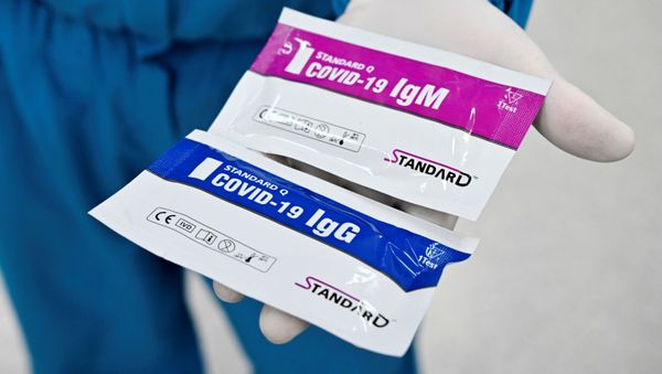 Медицинский работник демонстрирует устройство для быстрого тестирования COVID-19  - Sputnik Азербайджан